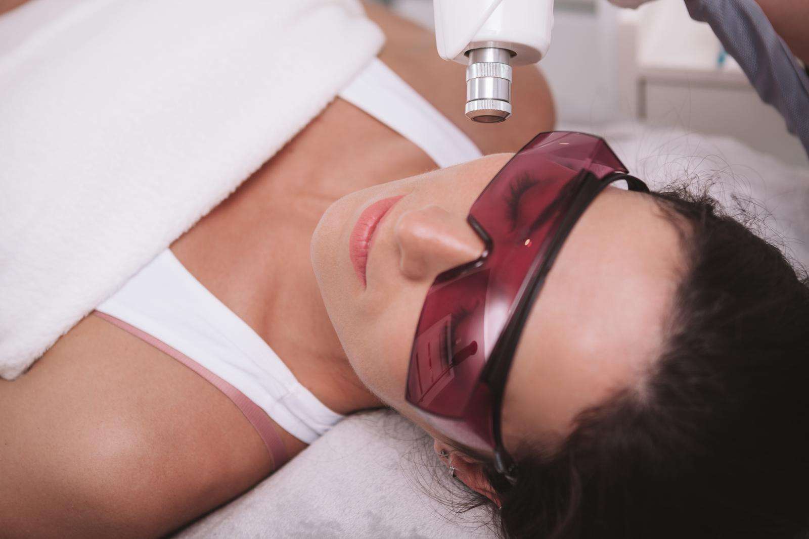 Patient receiving Phoenix CO₂ laser skin resurfacing treatment to improve wrinkles, sun damage, acne scars, and overall skin texture.
